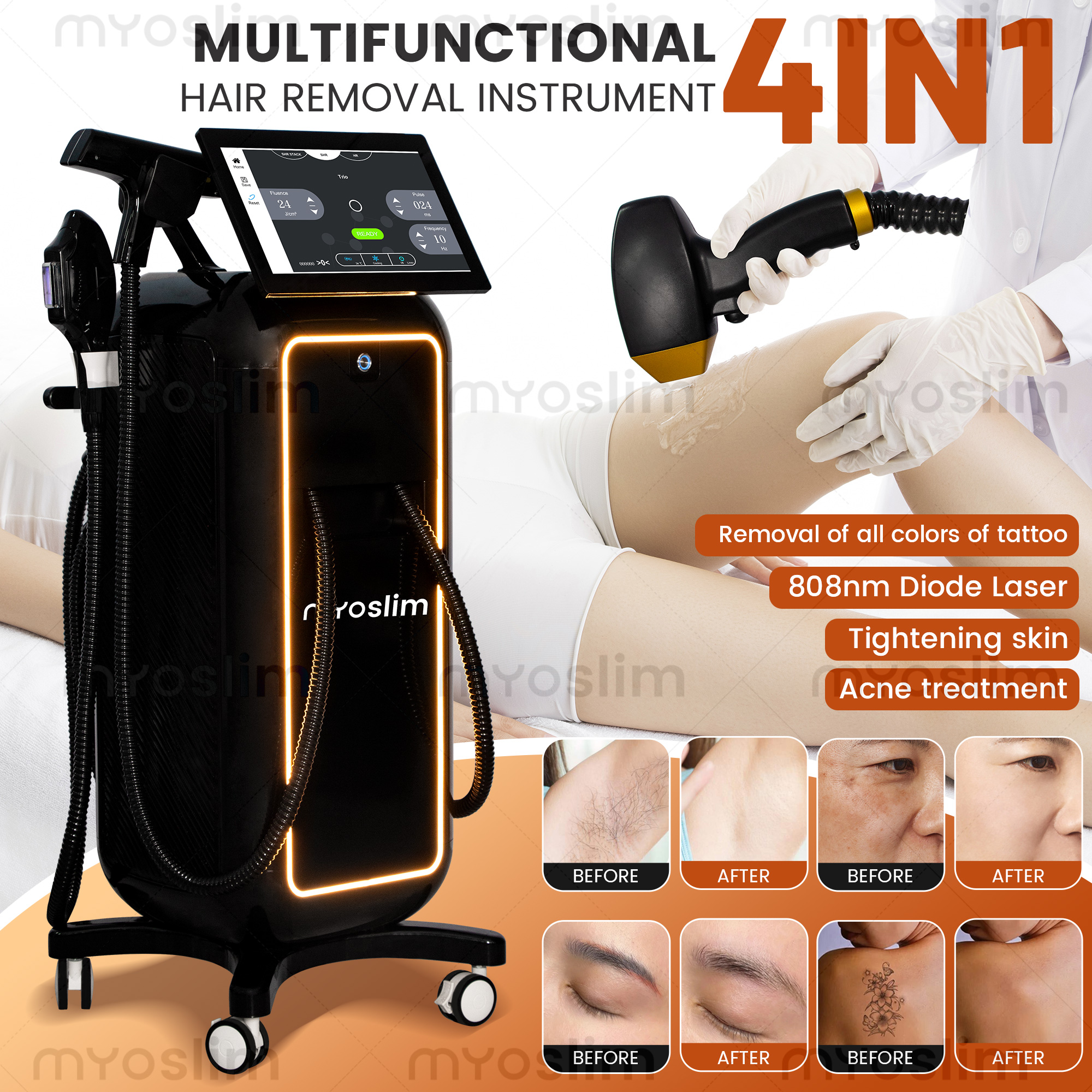 5000W Professional 4-in-1 Diod - Industrial Laser Cleaning Machine ulasan dan harga
