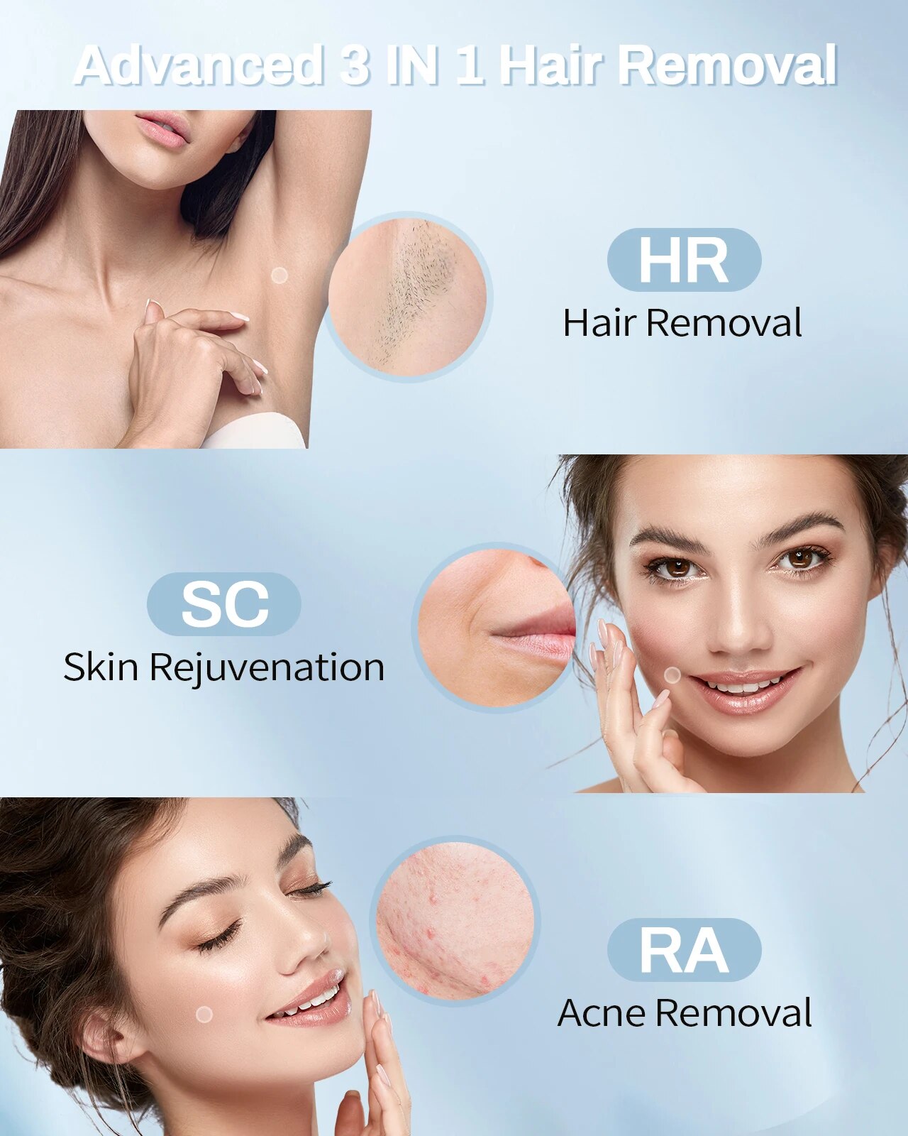 IPL Laser Hair Removal Device  - Industrial Laser Cleaning Machine ulasan dan harga