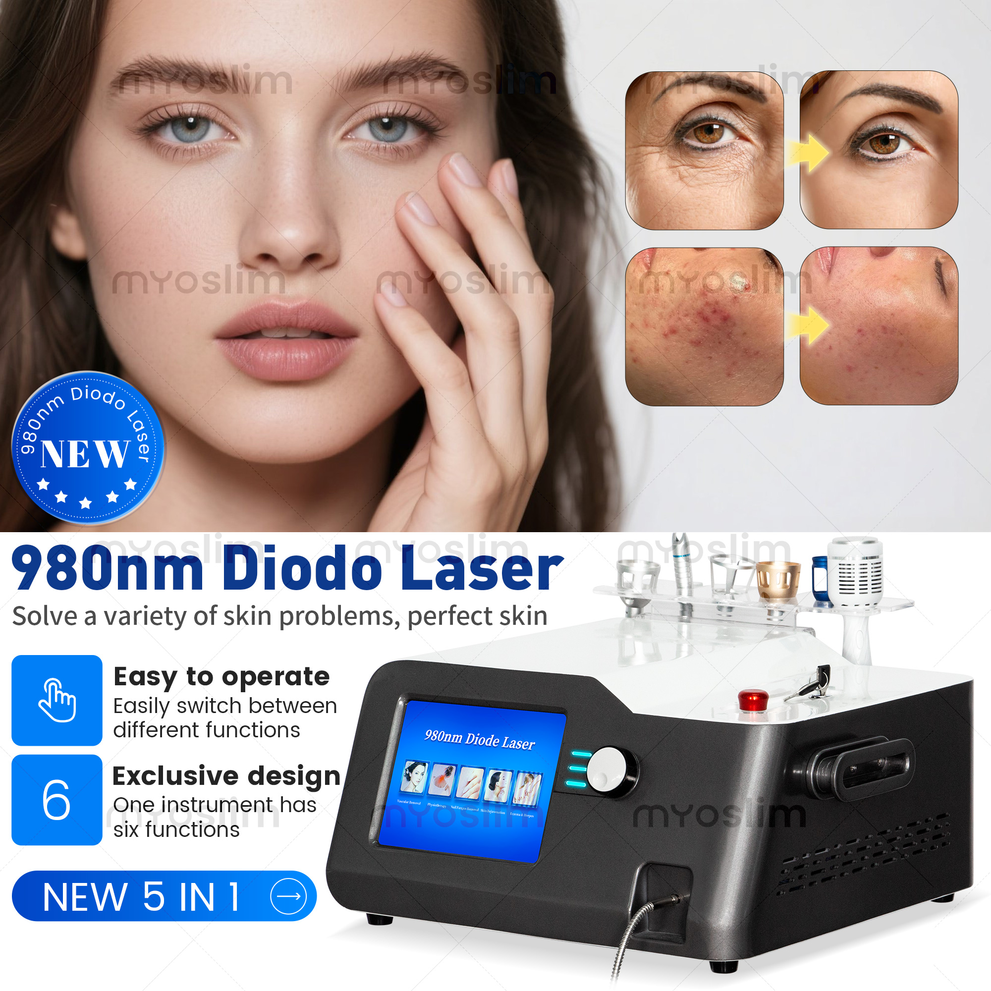 Portable 30W 5 in 1 980 nm Dio - Industrial Laser Cleaning Machine ulasan dan harga